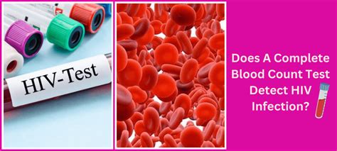 early hiv cbc results|Full blood count as a diagnostic clue to HIV infection .